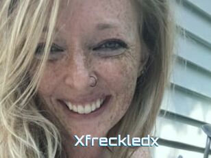 Xfreckledx